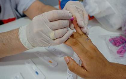 Farmácias podem fazer exame de análise clínica, como testes de HIV e Beta-hCG