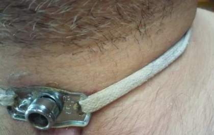 Paciente espera há 10 meses por cirurgia para voltar a falar