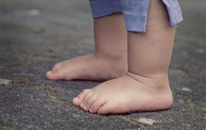 Crianças entre 3 e 6 anos tem pé chato, saiba como tratar