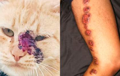 Esporotricose: doença transmitida por gatos já contaminou 48 pessoas em MS