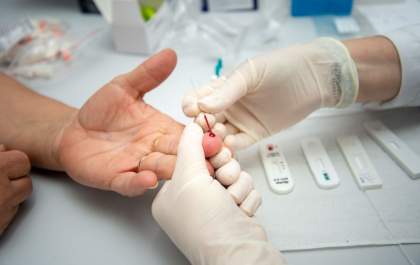 Ministério da Saúde Reestrutura Comissão Nacional de HIV/Aids