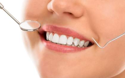 Dentes brancos e outros mitos que você precisa saber