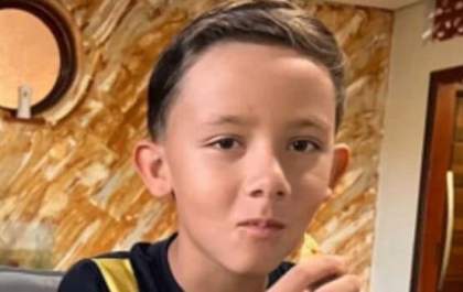 Menino de 12 anos precisa de cirurgia para reconstrução facial e família pede ajuda em vaquinha online