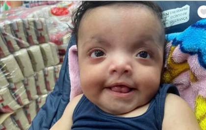 Mãe busca ajuda para realizar exame que pode diagnosticar síndrome rara em sua filha