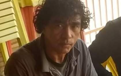 Vakinha virtual tenta arrecadar R$ 40 mil para motociclista que perdeu o nariz em colisão
