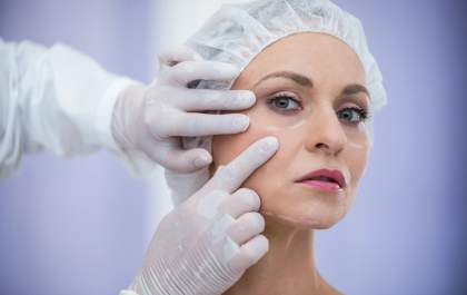 Blefaroplastia: como funciona a cirurgia na região dos olhos?