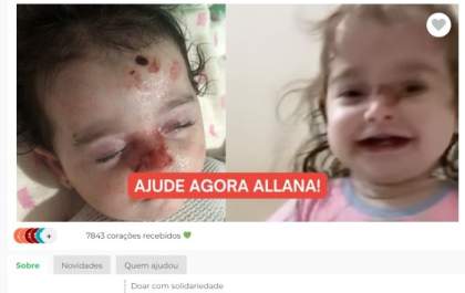 Mãe denuncia ‘vaquinha’ falsa para arrecadar dinheiro para criança de Birigui