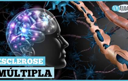 O que é esclerose múltipla? Quais os sintomas e o tratamento?