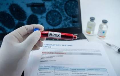 Ministério da Saúde alerta para aumento de casos de mpox no Brasil