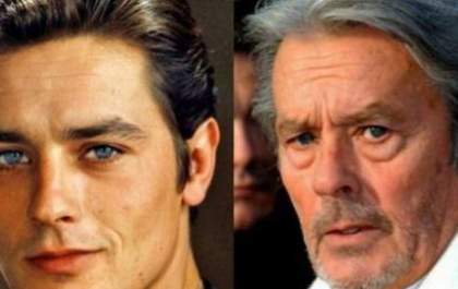 Eu era feio, agora sou Alain Delon