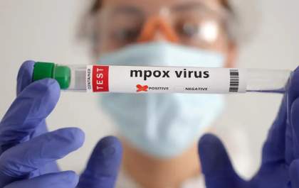 OMS estima custo de US$ 135 milhões em 6 meses para conter mpox