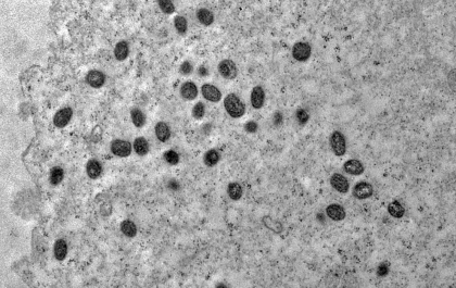 Brasil em atenção contra Mpox: 2024 já supera 2023 no número de casos