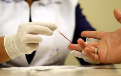 Brasil registra menor mortalidade por Aids da série histórica