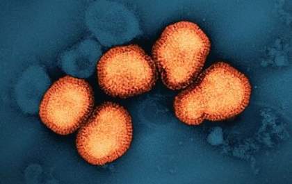 EUA reporta primeiro caso grave de gripe aviária em humanos