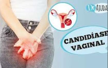 Candidíase Vaginal: o que é, sintomas, diagnóstico, tratamento e prevenção