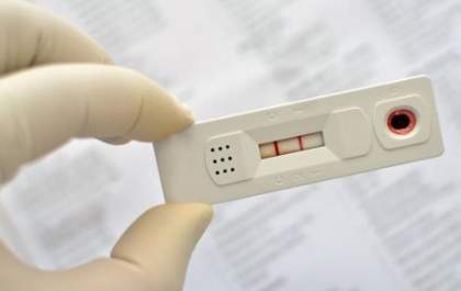 Ministério da Saúde inicia distribuição de testes rápidos para dengue em MS