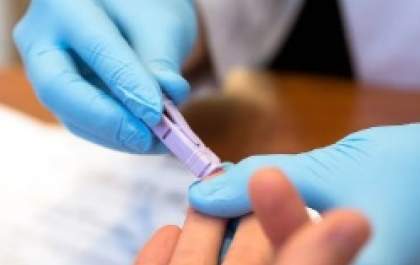 Ministério da Saúde envia 2,5 mil testes rápidos de dengue para Araçatuba