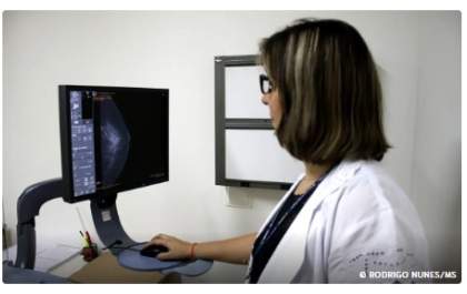 Entidades médicas pedem faixa etária maior para mamografia de rastreio