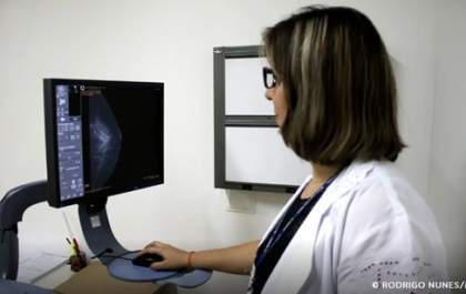 Entidades médicas pedem faixa etária maior para mamografia de rastreio