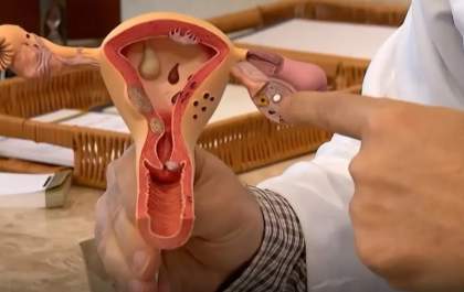 Endometriose: conheça os sintomas e saiba como tratar a doença