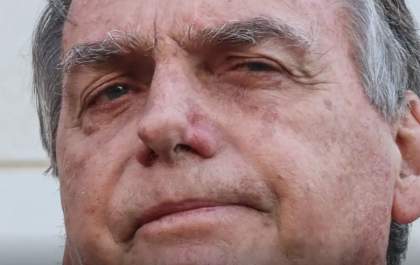 Bolsonaro apresenta piora clínica e vai passar por novos exames