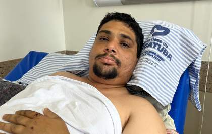 Condutor de moto atingida por caminhonete passará por cirurgia e não tem previsão de alta