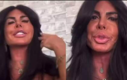 Gretchen adota novo procedimento facial e impressiona os fãs