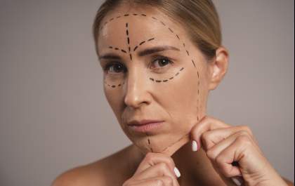Fios de PDO promovem lifting facial sem cirurgia e com resultados naturais