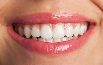 Brancorexia: entenda a obsessão por dentes brancos e os riscos à saúde bucal