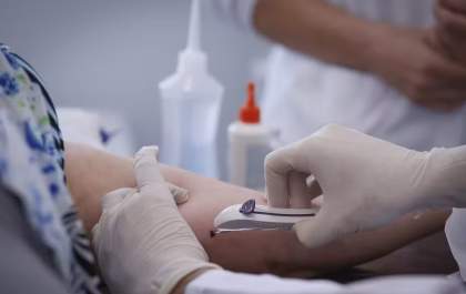 Implante contraceptivo hormonal será oferecido gratuitamente pelo SUS