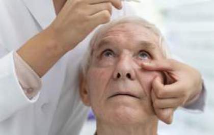 Glaucoma: um exame simples que pode salvar sua visão
