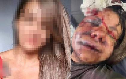 Ex-jogador de basquete é preso após espancar ex-namorada com mais de 60 socos no rosto