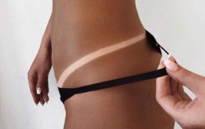 TJ-SP dobra valor de indenização para cliente que sofreu queimaduras após sessão de bronzeamento em Andradina