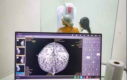Ministério da Saúde amplia oferta de mamografias no SUS para mulheres a partir dos 40 anos