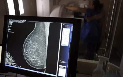Ministério da Saúde passa a recomendar mamografia a partir dos 40 anos