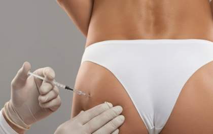 Prepare-se para a praia: glúteos mais firmes e modelados com harmonização