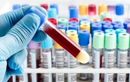 Coletas de exames laboratoriais serão realizadas na zona rural de Andradina
