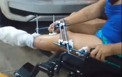 Processo administrativo deve apurar recusa de ambulância para paciente no pronto-socorro de Birigui