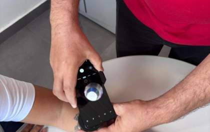 Teledermatologia fortalece o SUS em MS e agiliza diagnóstico de câncer de pele