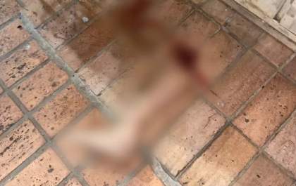 Motorista atropela mulher, arranca perna e foge em MS