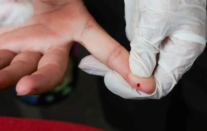 SUS passa a oferecer teste rápido de dengue