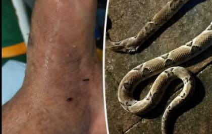 Picadas de cobras venenosas acendem alerta após dois casos em sequência