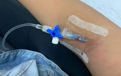 SES orienta prevenção contra hantavirose em MS