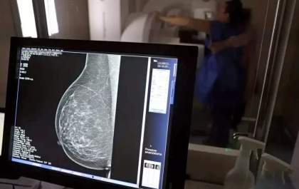 SUS passa a oferecer teste genético para câncer de mama