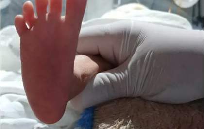 Bebê que nasceu prematuro e com necessidades especiais aguarda adoção em MS