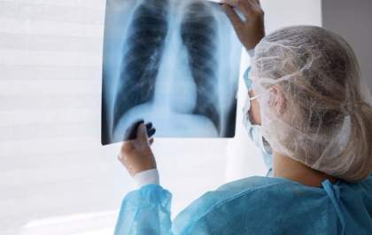 Ministério da Saúde cria comitê para diagnóstico da tuberculose
