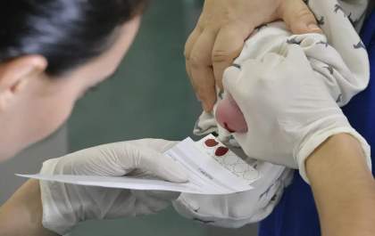 Atrofia Muscular Espinhal: diagnóstico precoce faz diferença