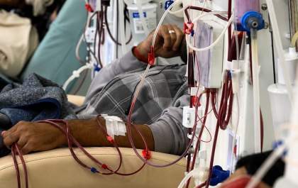 Doença renal: diagnóstico precoce é desafio no Brasil