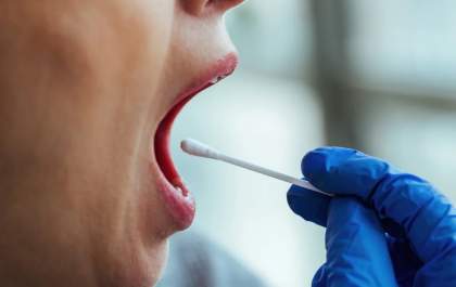 Teste de saliva pode detectar câncer colorretal