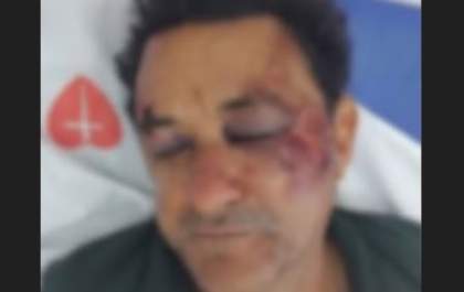 Acusado de agredir garçom em Valparaíso é preso